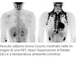 termoregolazione